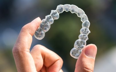 Invisalign & ClearCorrect Clear Aligners in Etobicoke